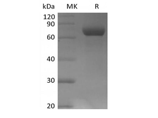 Recombinant Human Leukocyte Ig-Like Receptor B2/LILRB2/ILT4/CD85d (C-Avi-6His) Biotinylated - ABMIUM