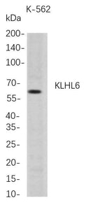 Anti-Human KLHL6 Antibody [B712]