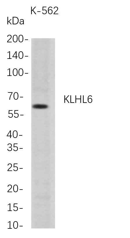 Anti-Human KLHL6 Antibody [B712] - ABMIUM