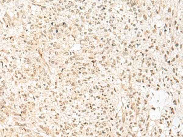 Anti-Human/Mouse RBX1 Antibody
