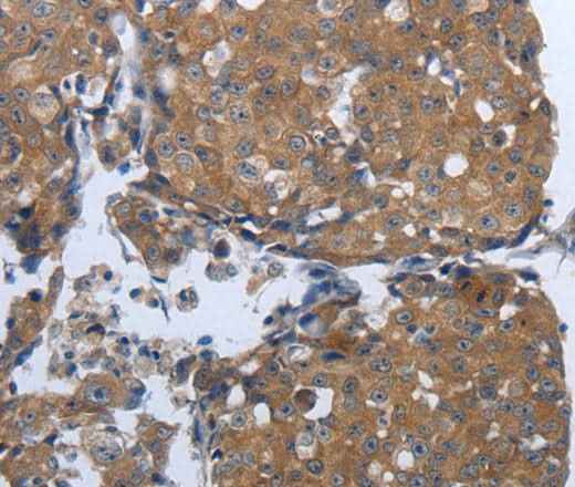 Anti-Human PDIA2 Antibody