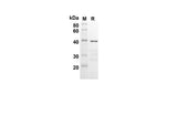 SDS-PAGE analysis of Human BCL2 proteins, 2 μg/lane of Recombinant Human BCL2 proteins was resolved with SDS-PAGE under reducing conditions, showing bands at 43.1 kDa.