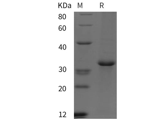SDS-PAGE analysis of Mouse TH proteins, 2 μg/lane of Recombinant Mouse TH proteins was resolved with SDS-PAGE under reducing conditions, showing bands at 32 kDa.