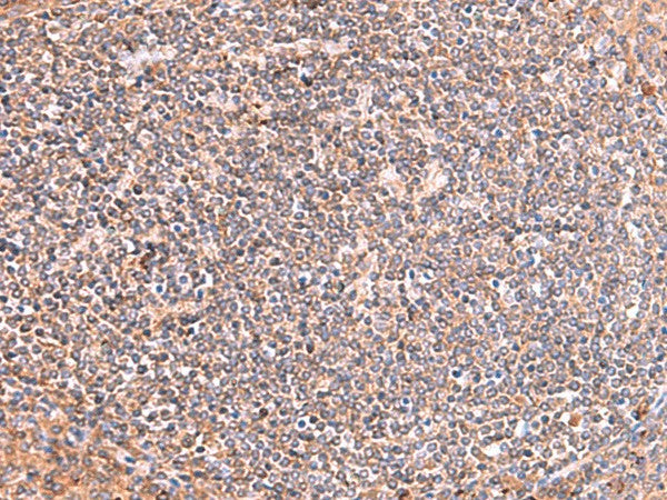 Immunohistochemistry of paraffin-embedded Human tonsil tissue using PHKG2 Polyclonal Antibody at dilution of 1:60(×200)