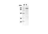 SDS-PAGE analysis of Human PGFRA proteins , 2 μg/lane of Recombinant Human PGFRA proteins was resolved with SDS-PAGE under reducing conditions , showing bands at 80 kDa.