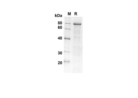 SDS-PAGE analysis of Human PGFRA proteins , 2 μg/lane of Recombinant Human PGFRA proteins was resolved with SDS-PAGE under reducing conditions , showing bands at 80 kDa.