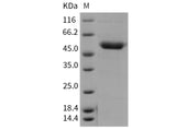 Recombinant Mouse CD39/ENTPD1 Protein (His Tag) - ABMIUM