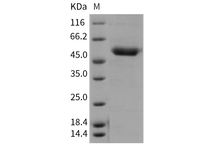 Recombinant Mouse CD39/ENTPD1 Protein (His Tag) - ABMIUM