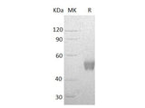 Recombinant Human NCR3/NKp30 Protein (Fc Tag) - ABMIUM