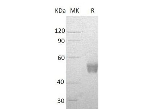 Recombinant Human NCR3/NKp30 Protein (Fc Tag) - ABMIUM