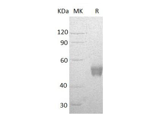 Recombinant Human NCR3/NKp30 Protein (Fc Tag) - ABMIUM
