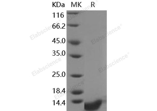 Recombinant Human COL6A3/Collagen-VI Protein - ABMIUM