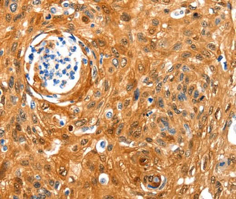 Anti-Human NCOR1 Antibody - ABMIUM