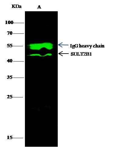 Anti-Human SULT2B1 Antibody [A1231] - ABMIUM