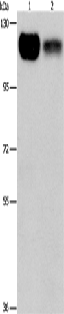 Anti-Human/Mouse/Rat PRKD1 Antibody - ABMIUM