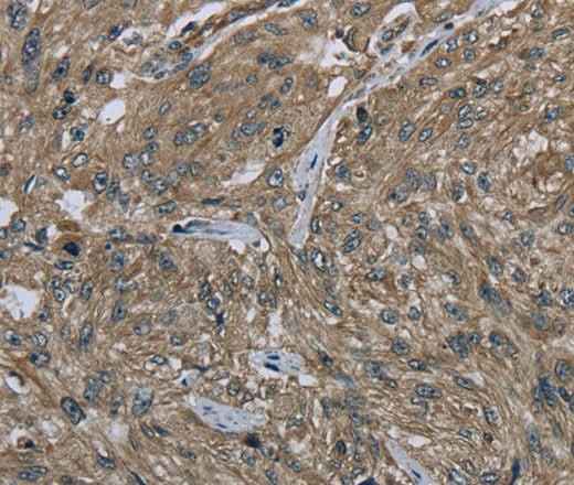 Anti-Human CLPS Antibody