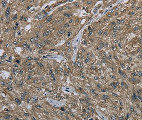 Anti-Human CLPS Antibody - ABMIUM