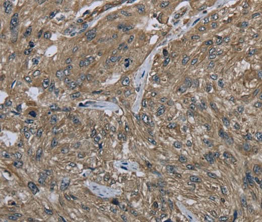 Anti-Human CLPS Antibody - ABMIUM