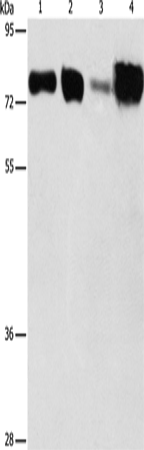 Anti-Human/Mouse/Rat ACSL4 Antibody - ABMIUM