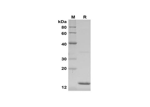 SDS-PAGE analysis of Rat IFN-γ proteins,2 μg/lane of Recombinant Rat IFN-γ proteins,was resolved with SDS-PAGE under reducing conditions,showing bands at 14 kDa.