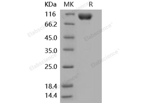 Recombinant Mouse IL18R1/CD218a Protein (His & Fc Tag) - ABMIUM