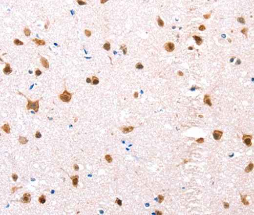 Anti-Human/Mouse/Rat ESR1 Antibody