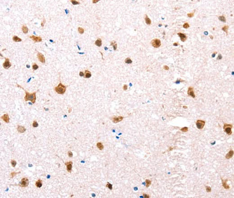 Anti-Human/Mouse/Rat ESR1 Antibody - ABMIUM