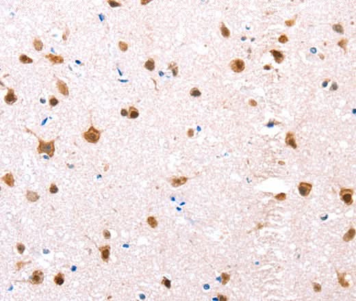 Anti-Human/Mouse/Rat ESR1 Antibody - ABMIUM