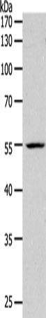 Anti-Human/Mouse PAX1 Antibody - ABMIUM
