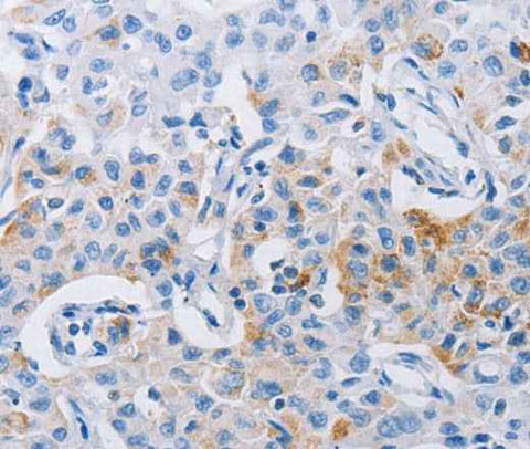 Anti-Human LRIG1 Antibody
