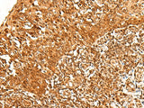 Immunohistochemistry of paraffin-embedded Human tonsil tissue using ADRM1 Polyclonal Antibody at dilution of 1:30(×200)
