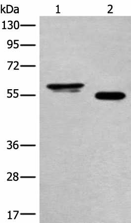 Western blot analysis of Human cervical cancer tissue and A549 cell lysates using HAS3 Polyclonal Antibody at dilution of 1:400