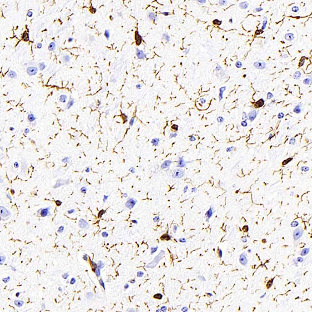 Immunohistochemistry analysis of paraffin-embedded mouse brain using AIF1 Monoclonal Antibody at dilution of 1:400.