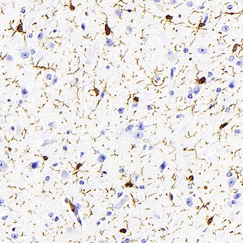 Immunohistochemistry analysis of paraffin-embedded mouse brain using AIF1 Monoclonal Antibody at dilution of 1:400.