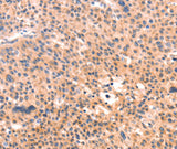 Anti-Human APBA2 Antibody - ABMIUM