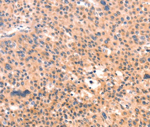 Anti-Human APBA2 Antibody - ABMIUM