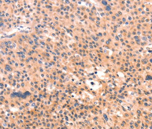 Anti-Human APBA2 Antibody - ABMIUM