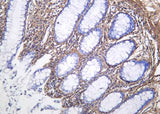 Anti-Human/Mouse/Rat Collagen VI Antibody [B1032]