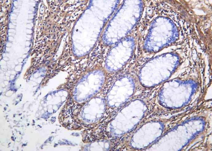Anti-Human/Mouse/Rat Collagen VI Antibody [B1032]