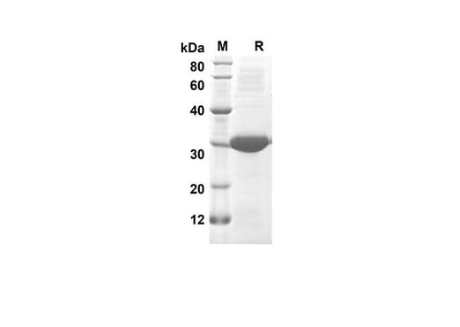 SDS-PAGE analysis of Rat CXCL7 proteins, 2 μg/lane of Recombinant Rat CXCL7 proteins was resolved with SDS-PAGE under reducing conditions, showing bands at 28.1 kDa.