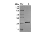 Recombinant Human TIMP-4/TIMP4 Protein (His Tag) - ABMIUM