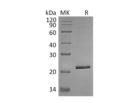 Recombinant Human TIMP-4/TIMP4 Protein (His Tag) - ABMIUM