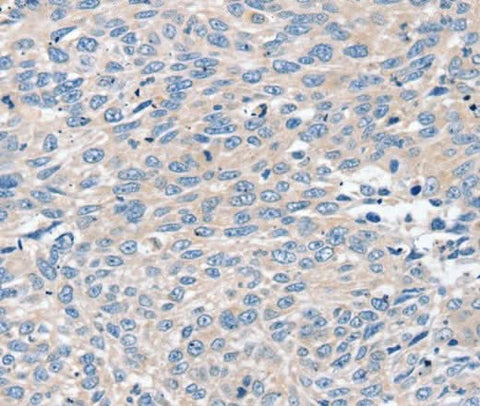 Anti-Human/Mouse ROR1 Antibody - ABMIUM