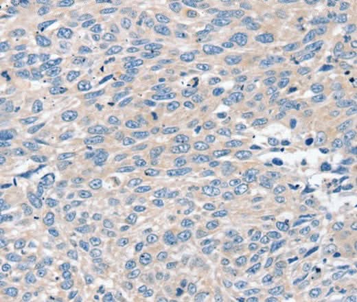 Anti-Human/Mouse ROR1 Antibody - ABMIUM