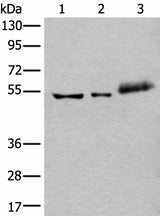 Western blot analysis of Hela cell Mouse kidney tissue and Human colorectal cancer tissue lysates using YY2 Polyclonal Antibody at dilution of 1:800