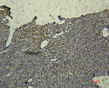 Anti-Human Transferrin Antibody [2F2] - ABMIUM