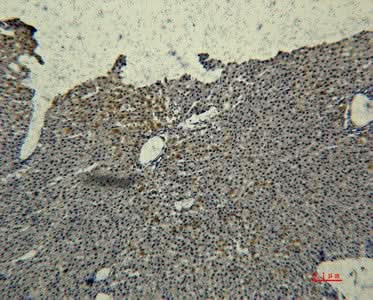 Anti-Human Transferrin Antibody [2F2] - ABMIUM