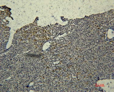 Anti-Human Transferrin Antibody [2F2] - ABMIUM