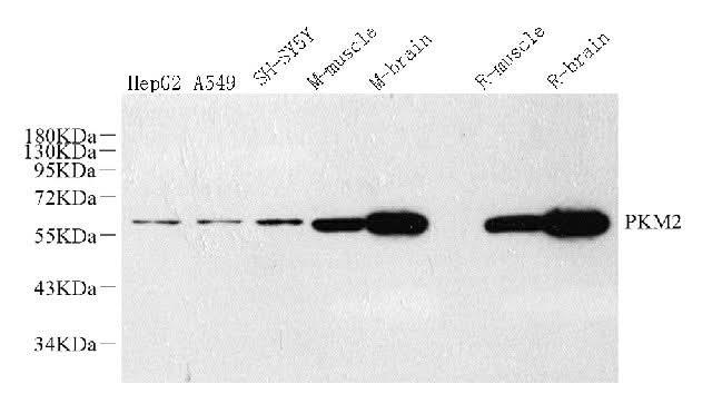 Western Blot analysis of various samples using PKM Polyclonal Antibody at dilution of 1:1000.