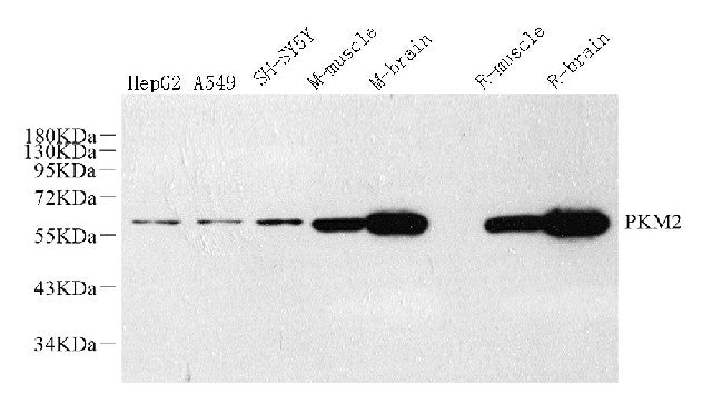 Western Blot analysis of various samples using PKM Polyclonal Antibody at dilution of 1:1000.
